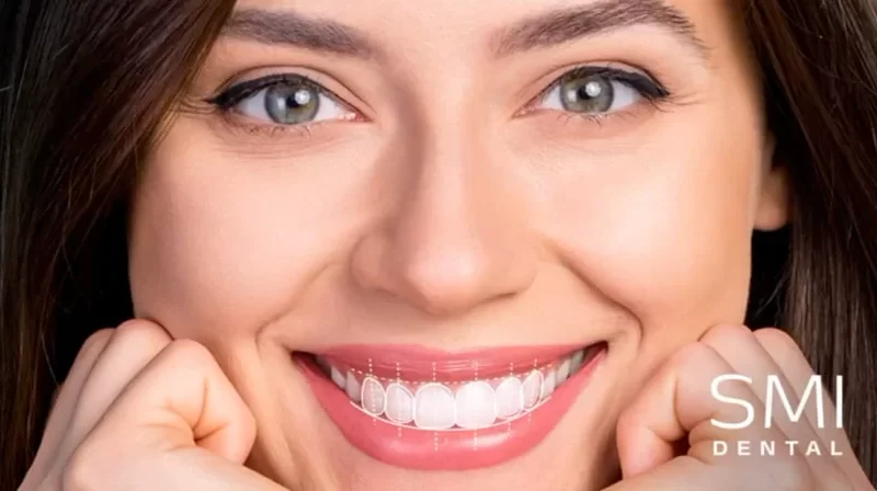 Smile Makeover Care Tips | SMI Dental | General Dentistry near me