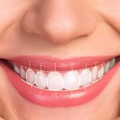Celebrity Smile Dental Clinic in St. Petersburg, FL | Teeth Aligners Near Me